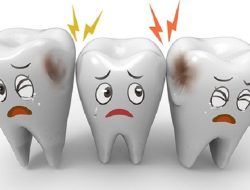 Tips Meredakan Sakit Gigi yang Efektif